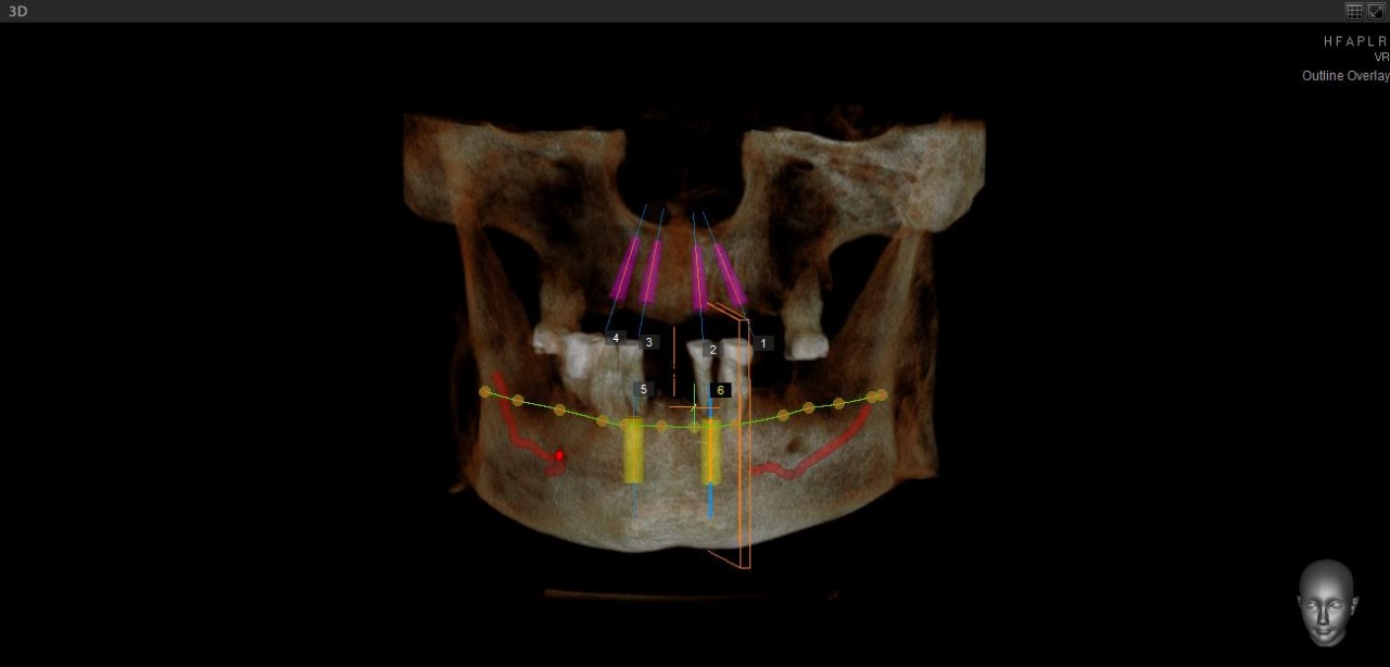 Germán López Álvarez